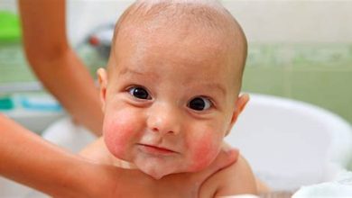 Bebeğin Alerjik Cilt Problemleri İçin Doğal Tedavi Yöntemleri