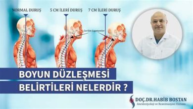 Boyun Düzleşmesi Nedir? Boyun Düzleşmesi Egzersizleri Nelerdir?