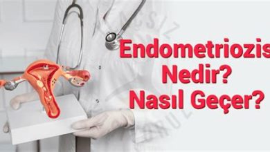 Endometriozis Nedir? Belirtileri Nelerdir?